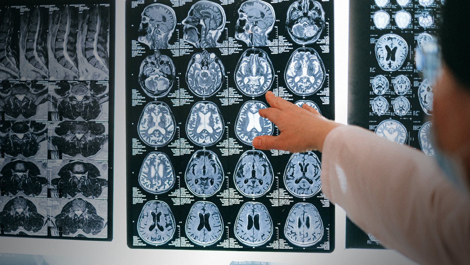 MRI technician looking at head and brain imaging