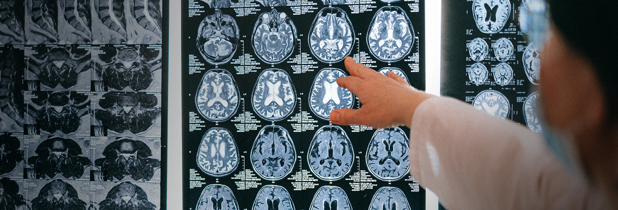 MRI technician looking at head and brain imaging